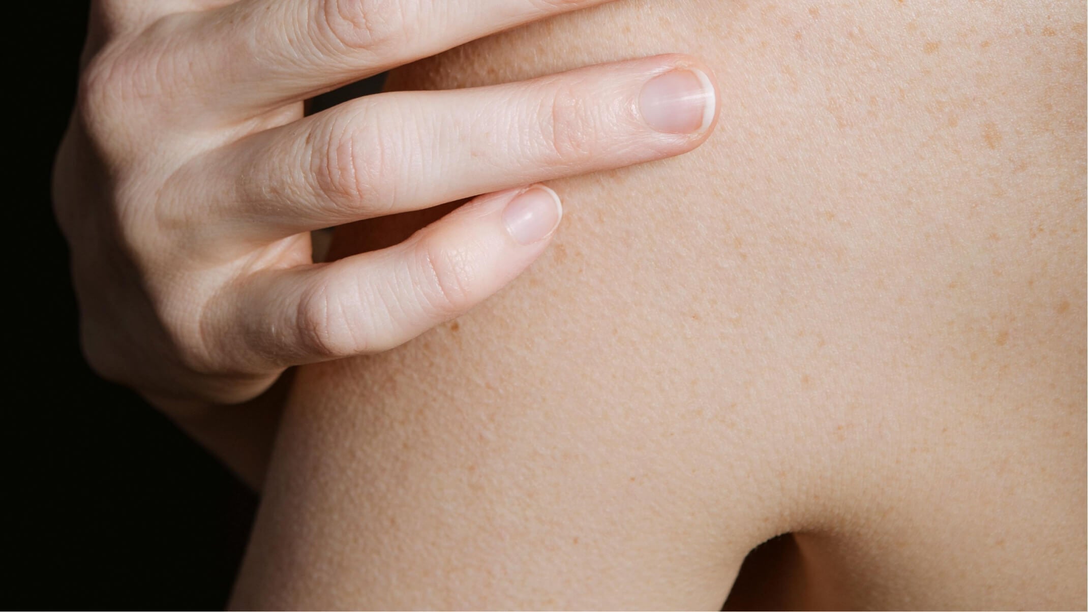 bronzage des peaux blanches ou sensibles