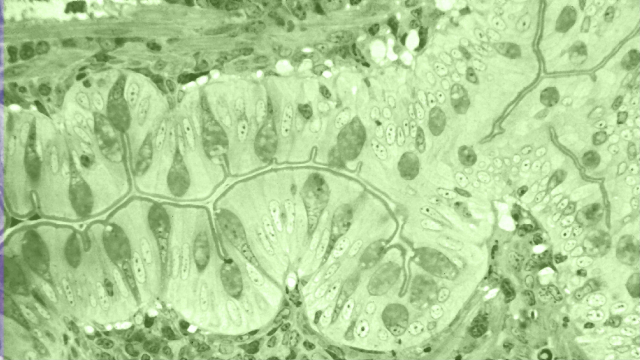 Détox colon : comment nettoyer son côlon naturellement