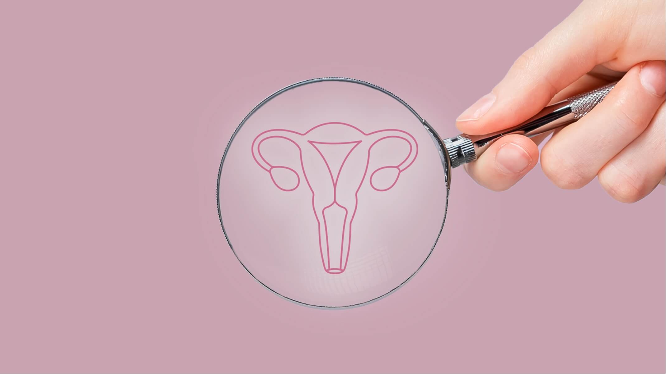 syndrome premenstruel approches naturelles en naturopathie