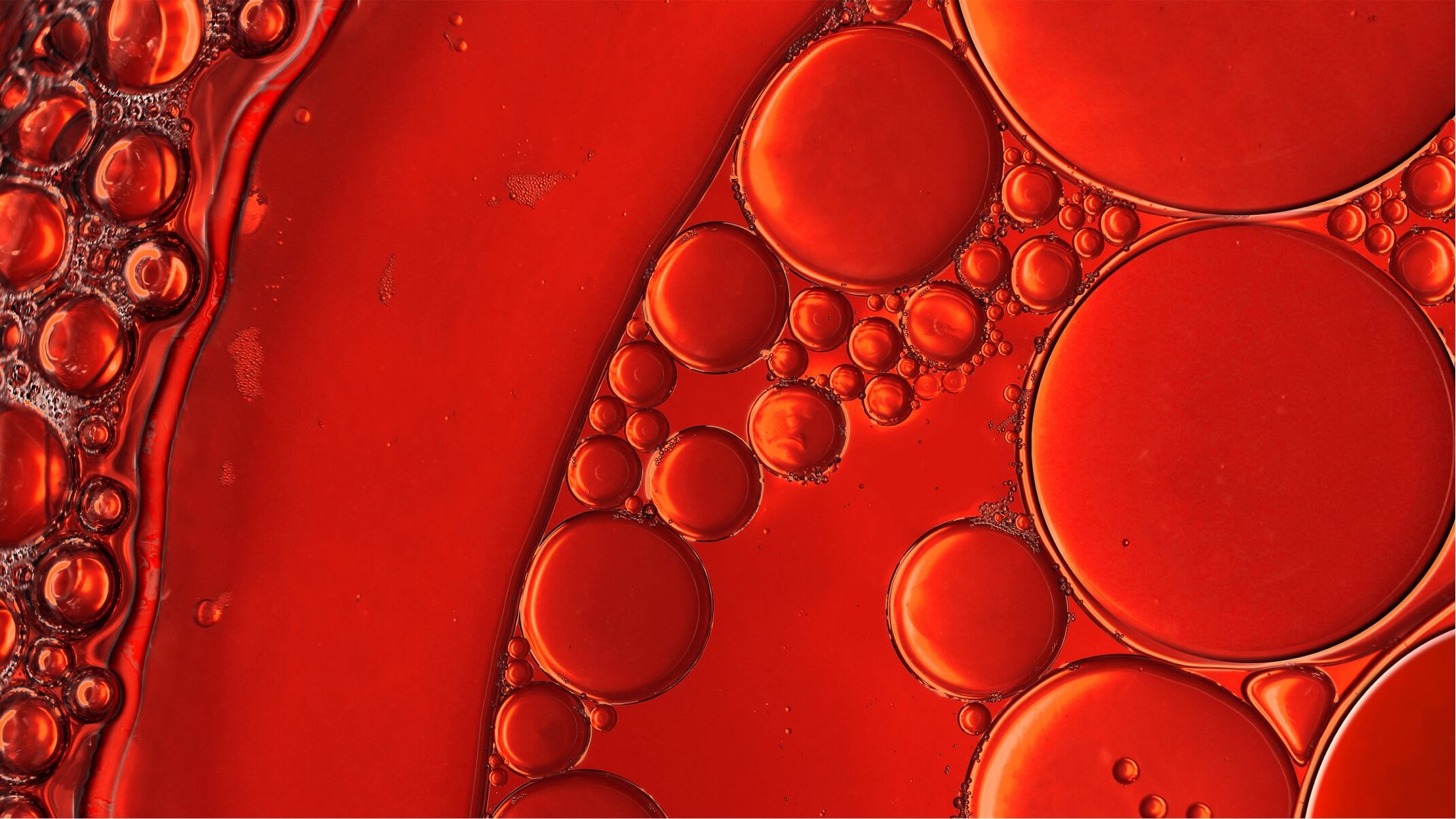 comment mieux controler des triglycerides eleves