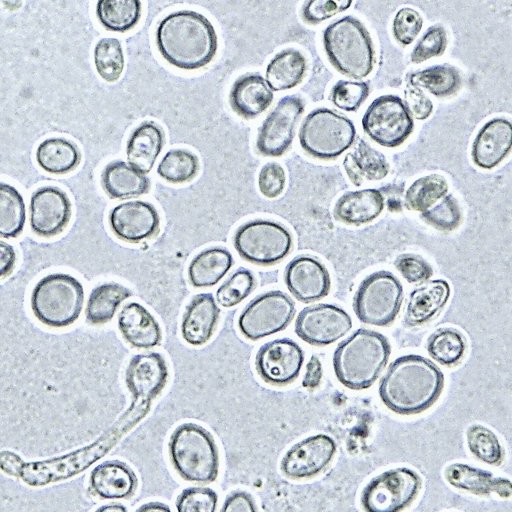 can i take too much bpc 157 BPC-157: Miracle Healing Peptide or Hidden Danger? can i take too much bpc 157 BPC-157: Miracle Healing Peptide or Hidden Danger?