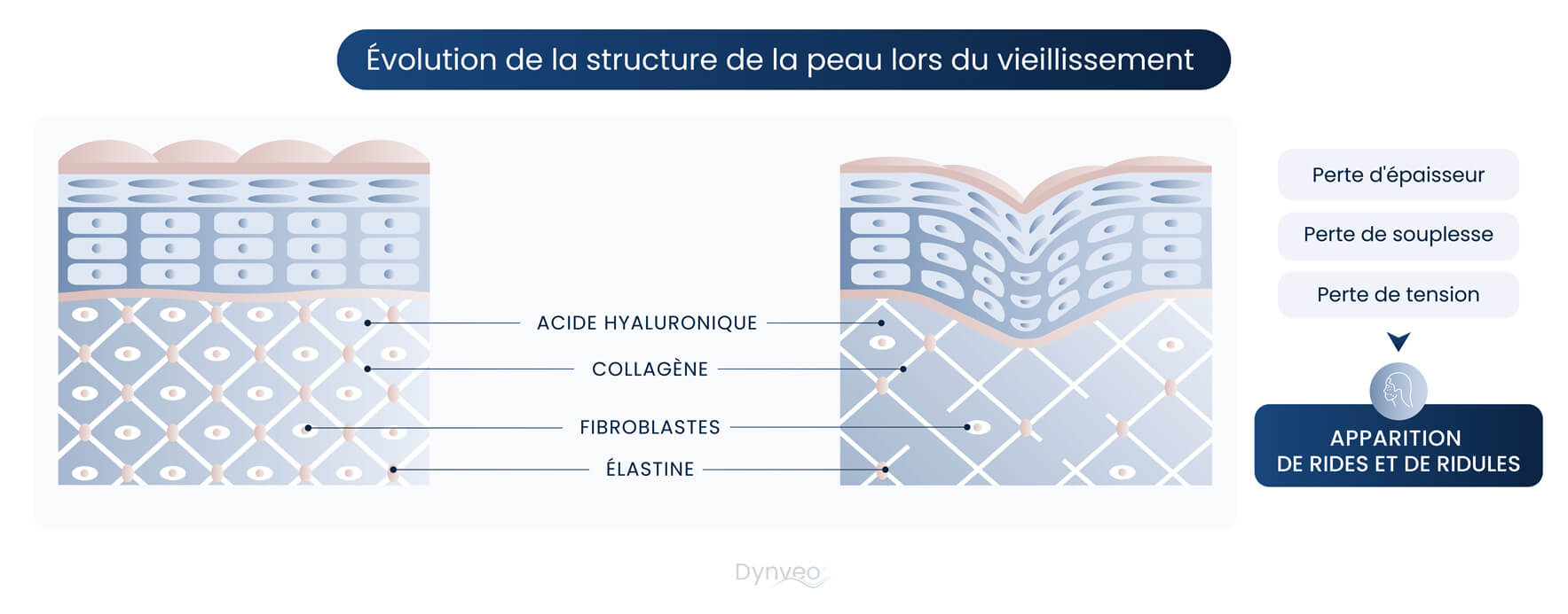 schema-vieillissement de la peau