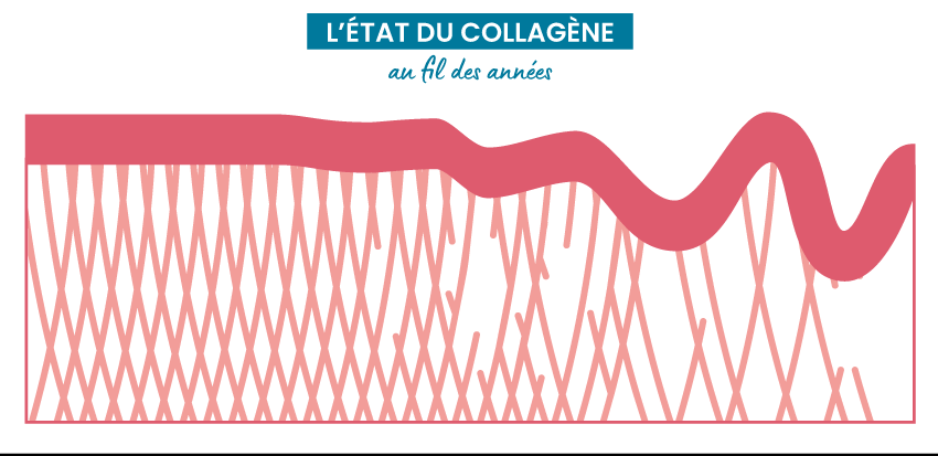 Diminution du collagène Diminution du collagène